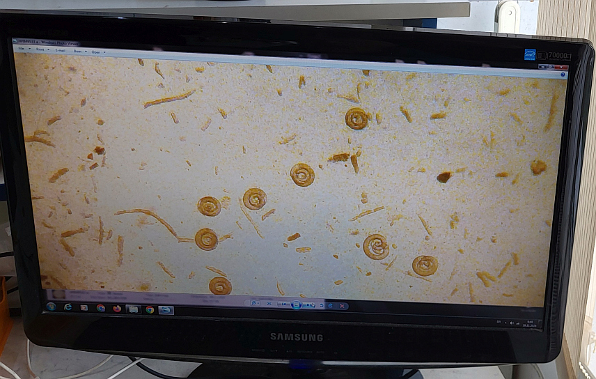 ПАЛЕ, 29. НОВЕМБРА /СРНА/ - На подручју општине Пале забиљежена су два случаја присуства трихинеле у месу дивљачи.