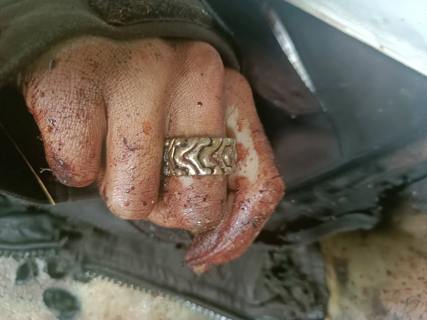 TРЕБИЊЕ, 22. АВГУСТА /СРНА/ - Обдукција тијела мушкарца који је пуцао на мјештане и полицију у мјесту Зови До показала да је ријеч о млађој особи, која је код себе имала карактеристичан прстен и наруквицу, те да сматра да је то довољно за идентификацију јер би га родбина могла препознати.