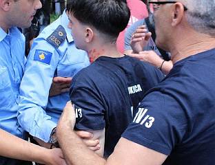 INTERNATIONAL COMMUNITY URGED TO REACT TO KOSOVO POLICE’S PROVOCATIONS AND EXCESSIVE FORCE