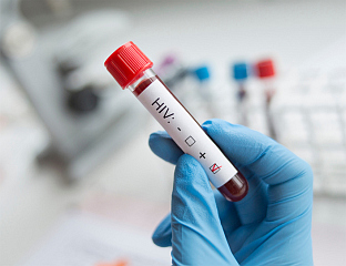 ОВЕ ГОДИНЕ ОСАМ ОБОЉЕЛИХ, А 213 ОД ПРВИХ ОТКРИВЕНИХ СЛУЧАЈЕВА