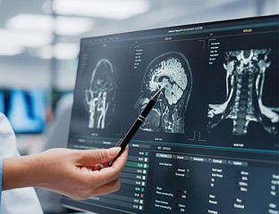 ДВА ОБРАСЦА МАСНОЋЕ ПОВЕЗАНА СА БРЖИМ СТАРЕЊЕМ МОЗГА