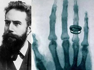 РЕНДГЕН - ФИЗИЧАР И НОБЕЛОВАЦ