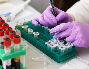 ОЛОВО У КРВИ ПОТВРЂЕНО КОД СВИХ 85 ТЕСТИРАНИХ ГРАЂАНА