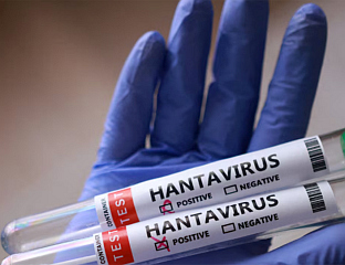 CANADIAN TESTS POSITIVE FOR HANTAVIRUS