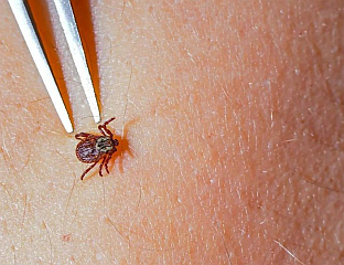 TICKS TRANSMIT NUMEROUS DISEASES; REMOVE THEM CAREFULLY