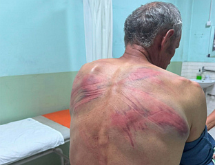 THE SO-CALLED KOSOVO POLICE MEMBERS BEAT SERB IN ZUBIN POTOK