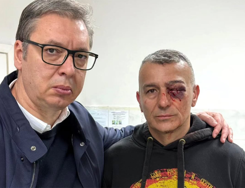 БЕОГРАД, 11. МАРТА /СРНА/ - Предсједник Србије Александар Вучић обишао је полицајца који је нападнут и тешко повријеђен током протеста испред зграде РTС.