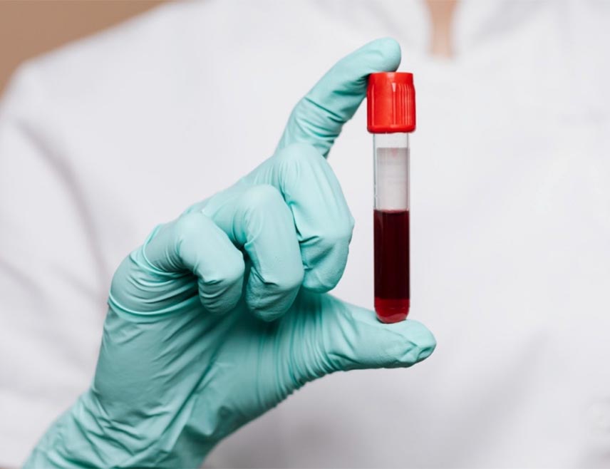 САРАЈЕВО, 15. ЈАНУАРА /СРНА/ - У Варешу је утврђено присуство олова у крви код 53 лица различитих генерација, од којих је код 17 потребна хитна медицинска помоћ.