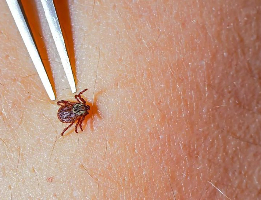 BANJA LUKA, JUNE 6 /SRNA/ – Ticks can transmit several diseases to humans, most of them zoonotic diseases that primarily affect animals, so they should be removed carefully, without pulling, twisting, or applying substances to the bite site, Nina Rodić Vukmir, Head of the Epidemiology Department at the Republika Srpska Public Health Institute, told SRNA.