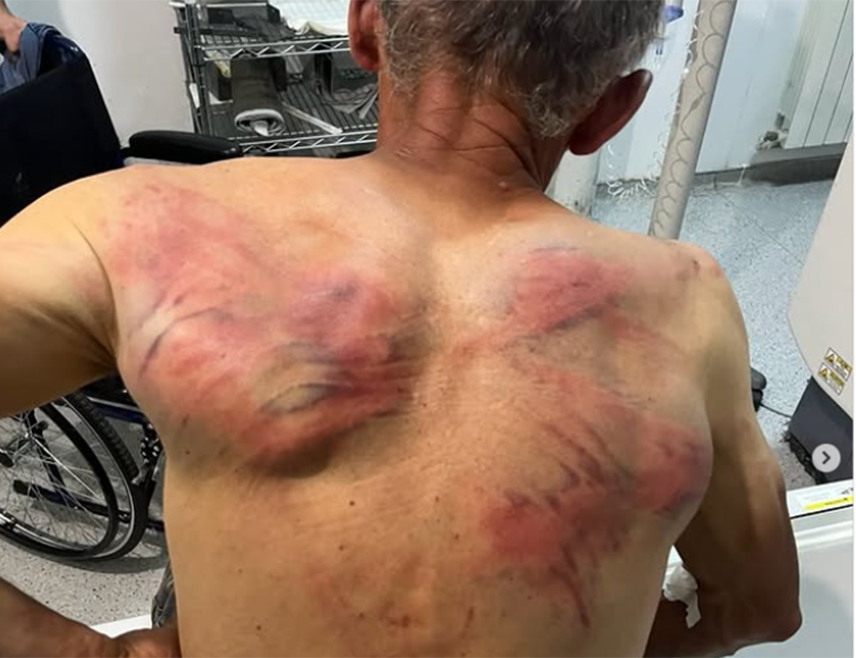 ЗУБИН ПОТОК, 11. АВГУСТА /СРНА/ - Припадници такозване косовске полиције упали су данас послије подне у породични дом Ненада Рашковића у селу Дрен у општини Зубин Поток, претукли га, одвели у шуму и везали за дрво, тражећи да призна да је починио ратни злочин над Албанцима, саопштено је из Српске листе.